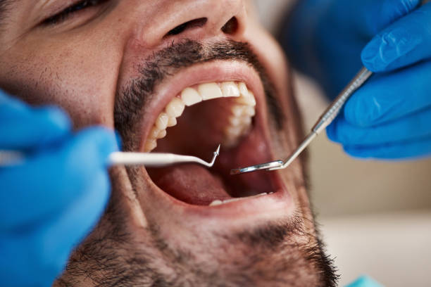 Best Orthodontic Emergency Dentist in Wauregan, CT